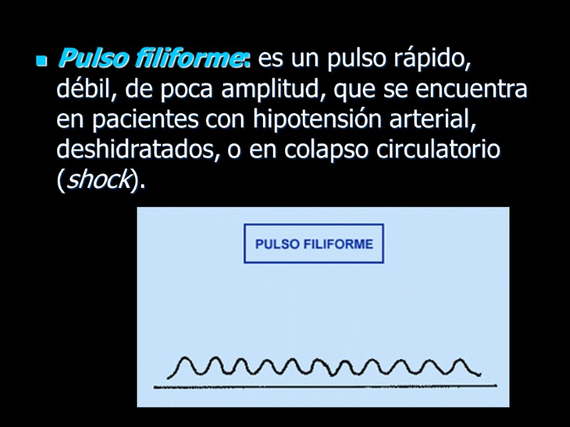 Pulso filiforme: es un pulso rápido, débil, de poca amplitud, que se encuentra en